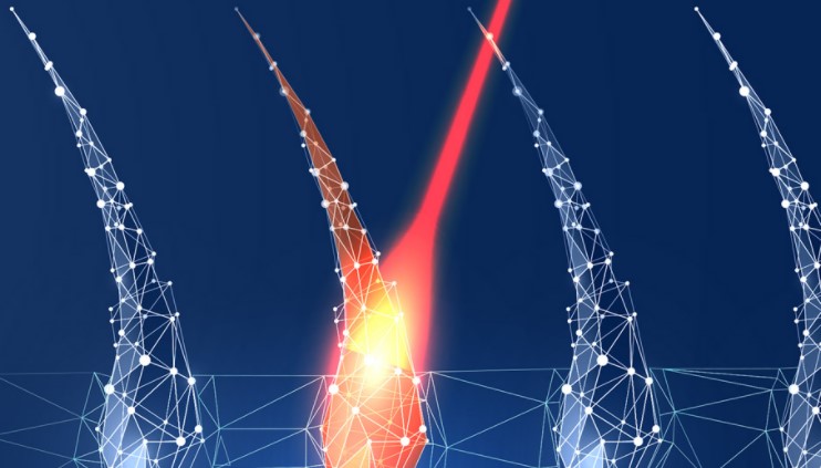depilacja laserowa Głogów włos nie odrasta