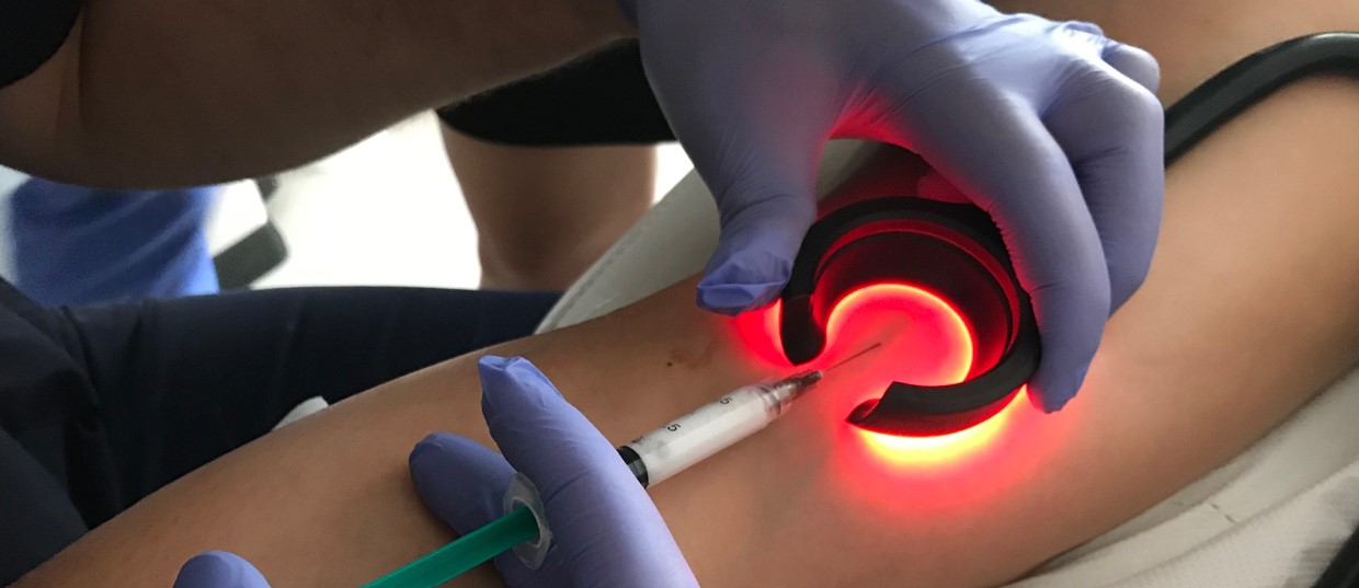 skleroterapia flebologia żył Głogów